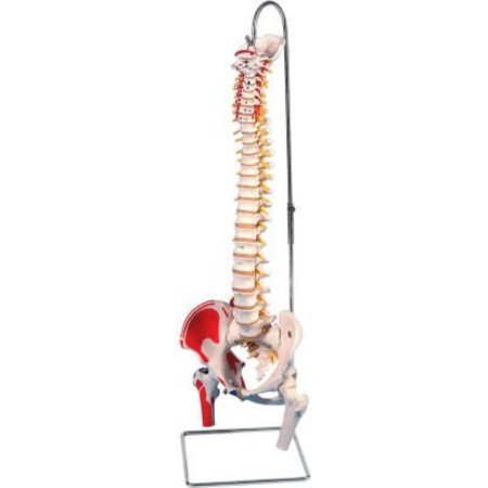 FABRICATION ENTERPRISES 3B® Anatomical Model - Flexible Spine, Classic, Femur Heads, Painted 961289